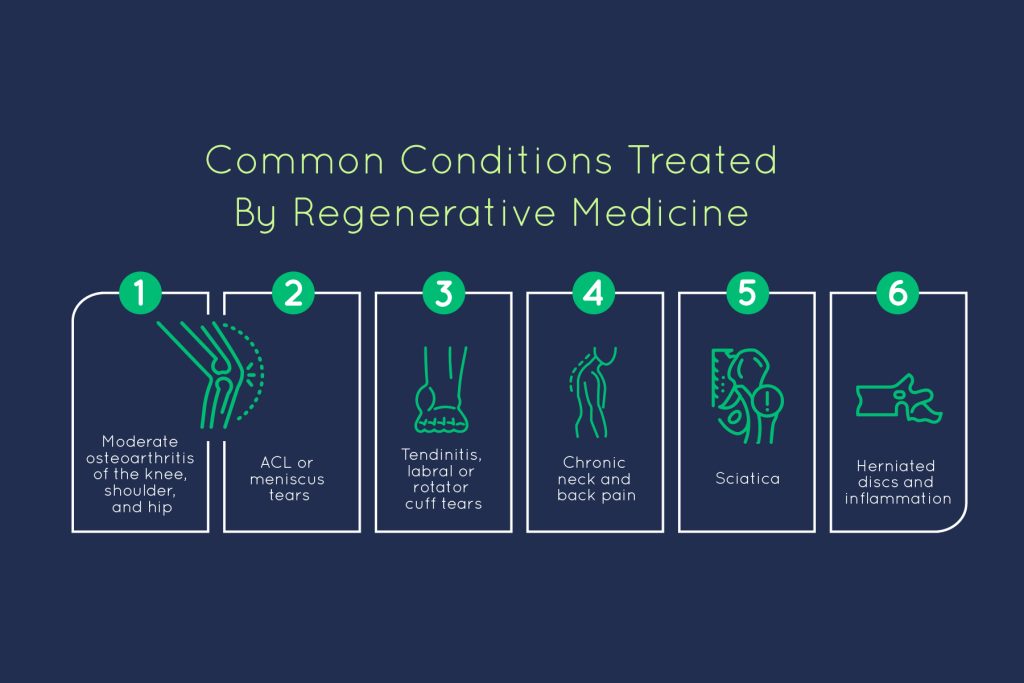 this table describes common conditions treated by regenerative medicine like back pain, knee pain, arthritis and degenerative disc disease.