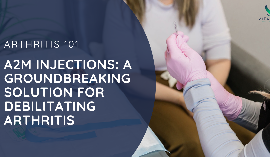 A2M Injections: A Groundbreaking Solution for Debilitating Arthritis