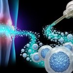 Regenerative Medicines: Why A2M Injections are the Most Effective? 1 A2M Injections 1024x576 1