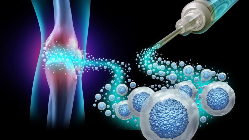 Exploring A2M Injections: Applications and Benefits in Modern Medicine