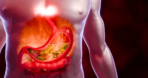 Is Functional Medicine Effective for Chronic Digestive Issues? An In-Depth Exploration